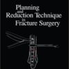 Planning and Reduction Technique in Fracture Surgery