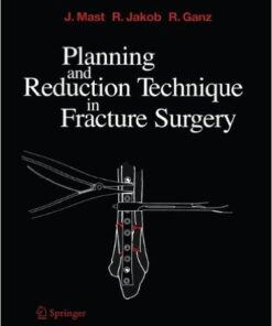 Planning and Reduction Technique in Fracture Surgery