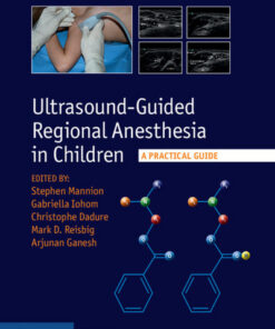 Ultrasound-Guided Regional Anesthesia in Children: A Practical Guide 1st Edition