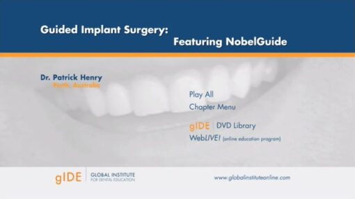 Guided Implant Surgery, Featuring NobelGuide