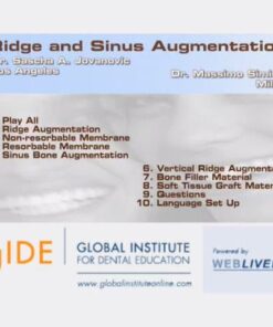 Ridge and Sinus Augmentation