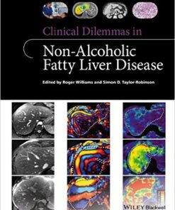 Clinical Dilemmas in Non-Alcoholic Fatty Liver Disease 1st Edition