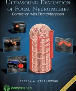 Ultrasound Evaluation of Focal Neuropathies: Correlation with Electrodiagnosis 1st Edition