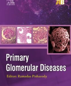 Primary Glomerular Diseases - ECAB