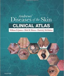 Andrews' Diseases of the Skin Clinical Atlas, 1e PDF