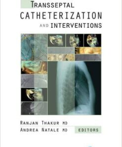 Transseptal Catheterization and Interventions 1st Edition