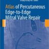 Atlas of Percutaneous Edge-to-Edge Mitral Valve Repair