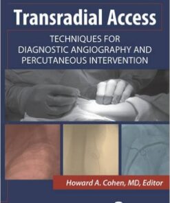 Transradial Access: Techniques for Diagnostic Angiography and Percutaneous Intervention