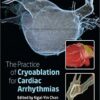 The Practice of Catheter Cryoablation for Cardiac Arrhythmias