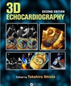 3D Echocardiography