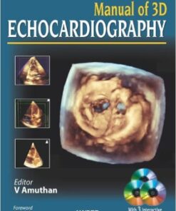 Manual of 3D Echocardiography