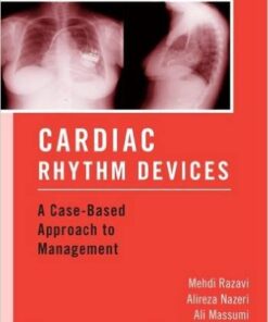 Cardiac Rhythm Devices: A Case-Based Approach to Management