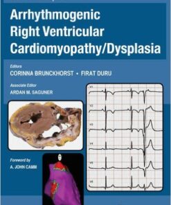 Current Concepts in Arrhythmogenic Right Ventricular Cardiomyopathy/Dysplasia