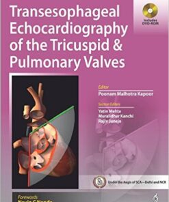 Transesophageal Echocardiography of the Tricuspid and Pulmonary Valves