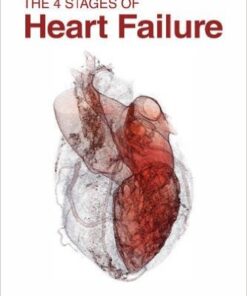 The 4 Stages of Heart Failure