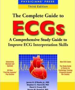 The Complete Guide to ECGs