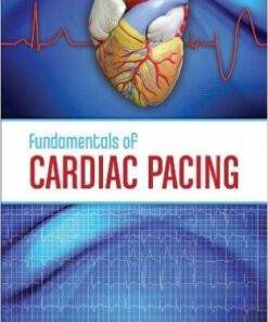 Fundamentals of Cardiac Pacing