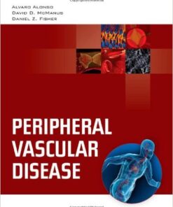 Peripheral Vascular Disease