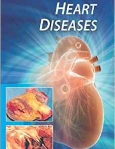 Manual of Coronary Heart Diseases