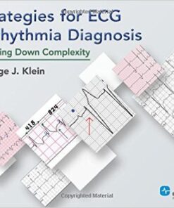 Strategies for ECG Arrhythmia Diagnosis: Breaking Down Complexity