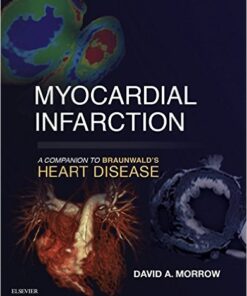 Myocardial Infarction: A Companion to Braunwald's Heart Disease