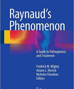 Raynaud’s Phenomenon: A Guide to Pathogenesis and Treatment