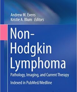 Non-Hodgkin Lymphoma