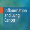 Inflammation and Lung Cancer