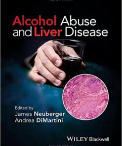 Alcohol Abuse and Liver Disease