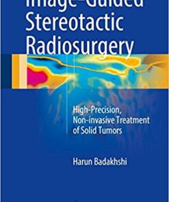 Image-Guided Stereotactic Radiosurgery 2016 : High-Precision, Non-Invasive Treatment of Solid Tumors