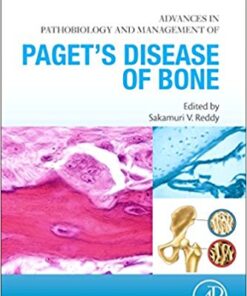 Advances in Pathobiology and Management of Paget's Disease of Bone