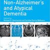 Non-Alzheimer’s and Atypical Dementia