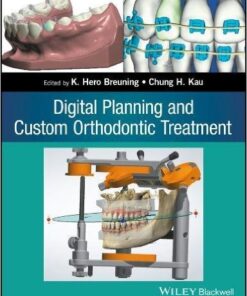 Digital Planning and Custom Orthodontic Treatment