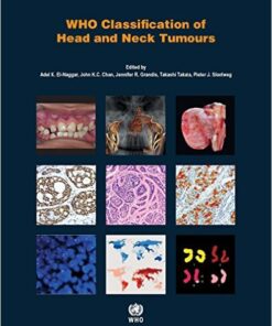 WHO Classification of Head and Neck Tumours (IARC WHO Classification of Tumours) 4th Edition