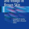 Melasma and Vitiligo in Brown Skin 1st ed. 2017 Edition