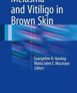 Melasma and Vitiligo in Brown Skin 1st ed. 2017 Edition