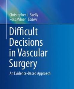 Difficult Decisions in Vascular Surgery: An Evidence-Based Approach (Difficult Decisions in Surgery: An Evidence-Based Approach)