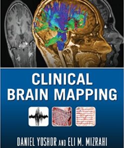 Clinical Brain Mapping 1st Edition