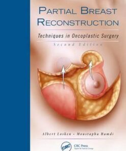 Partial Breast Reconstruction: Techniques in Oncoplastic Surgery 2nd Edition PDF