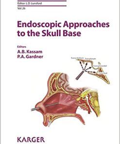 Endoscopic Approaches to the Skull Base (Progress in Neurological Surgery, Vol. 26) 1st Edition PDF