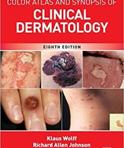 Fitzpatrick's Color Atlas and Synopsis of Clinical Dermatology, Eighth Edition  PDF