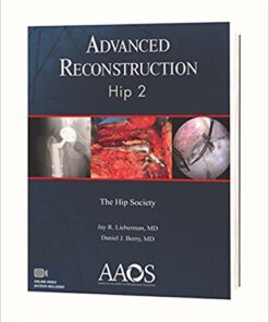 Advanced Reconstruction Hip 2 2nd Edition PDF  & VIDEO