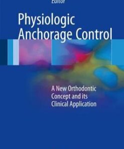 Physiologic Anchorage Control: A New Orthodontic Concept and its Clinical Application 1st ed. 2017 Edition PDF