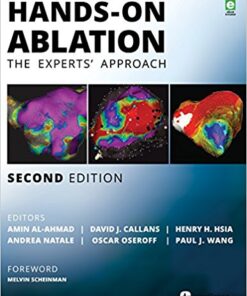 Hands-On Ablation: The Experts' Approach, 2nd Edition 2nd Edition PDF