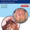 Endoscopic Sinonasal Dissection Guide: Including Orbit and Skull Base 2nd Edition PDF & VIDEO