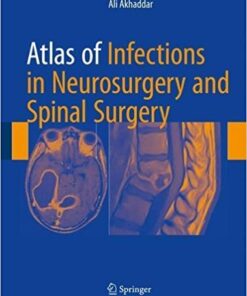 Atlas of Infections in Neurosurgery and Spinal Surgery 1st ed. 2017 Edition PDF