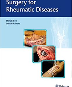 Surgery for Rheumatic Diseases 1st Edition PDF