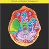 Arachnoid Cysts: Clinical and Surgical Management 1st Edition PDF