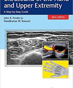 Ultrasound of the Hand and Upper Extremity: A Step-by-Step Guide 1st Edition PDF  & VIDEO