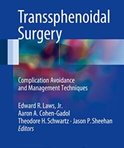 Transsphenoidal Surgery: Complication Avoidance and Management Techniques 1st ed. 2017 Edition PDF